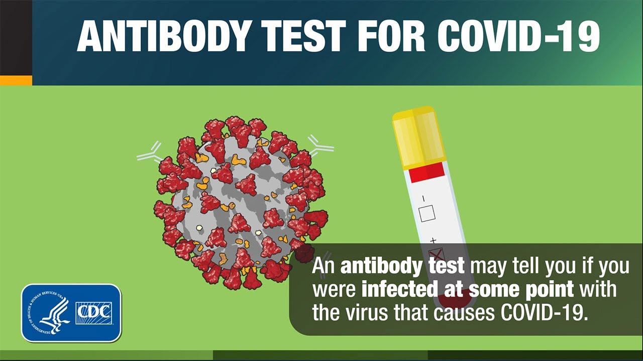 Kit to Detect Covid Antibody Developed