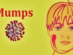 कंठमाला रोग