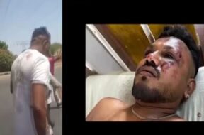 विमान हादसे में जीवित बचा इकलौता शख्स