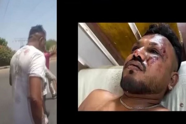 अहमदाबाद विमान हादसे में सिर्फ एक यात्री बचा, अस्पताल में चल रहा इलाज, शेष 241 लोगों की मौत