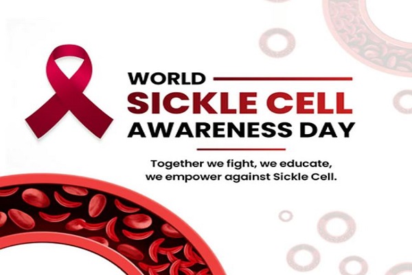 सिकल सेल बीमारी का पता लगाने के लिए 5.72 करोड़ लोगों की हुई स्क्रीनिंग : स्वास्थ्य मंत्रालय