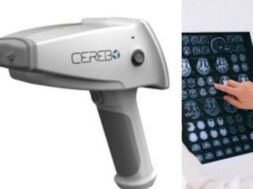 सेरेबो डिवाइस