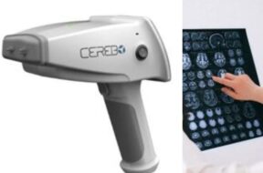 सेरेबो डिवाइस