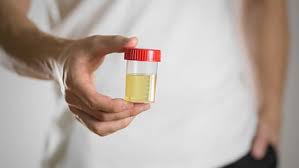 सेहत : यूरिन में दिख रहे हैं ये बदलाव, बढ़ तो नहीं गया किडनी डिजीज का खतरा, तुरंत करवा लेनी चाहिए जांच