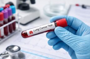 फेफड़े के कैंसर की जल्द जांच